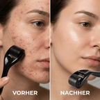 AfterCare Glättungsroller - Haut